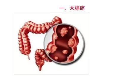 14 個癌種科普信息 高危對象 篩查建議和預防建議 精準生技股份有限公司